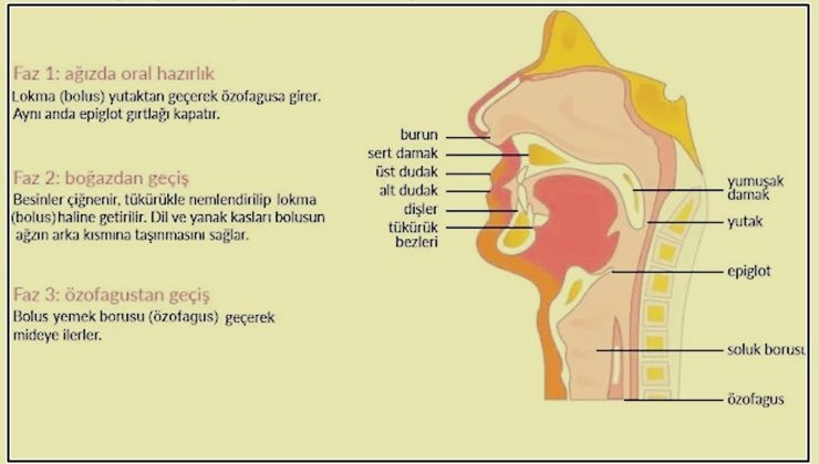 Yutma bozukluğu nedir?