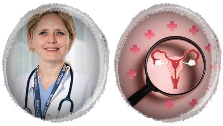 Poliendokrin Metabolik Over Sendromu’na (PMOS) ilişkin bilinen 8 yanlış