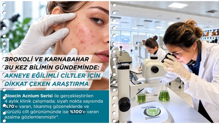 Brokoli ile karnabahar akne bakımında çığır açıyor